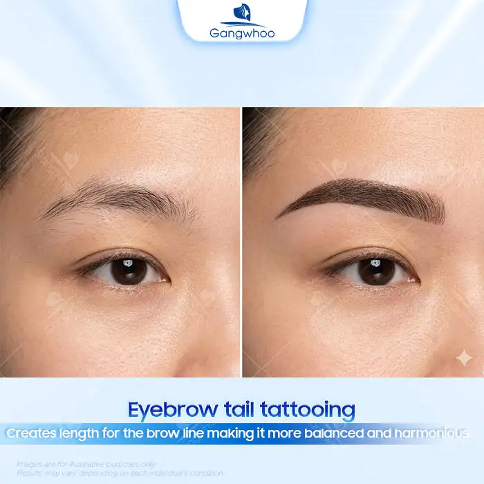 What Is Eyebrow Tail Tattooing? Who Is Suitable for Eyebrow Tail Tattooing?