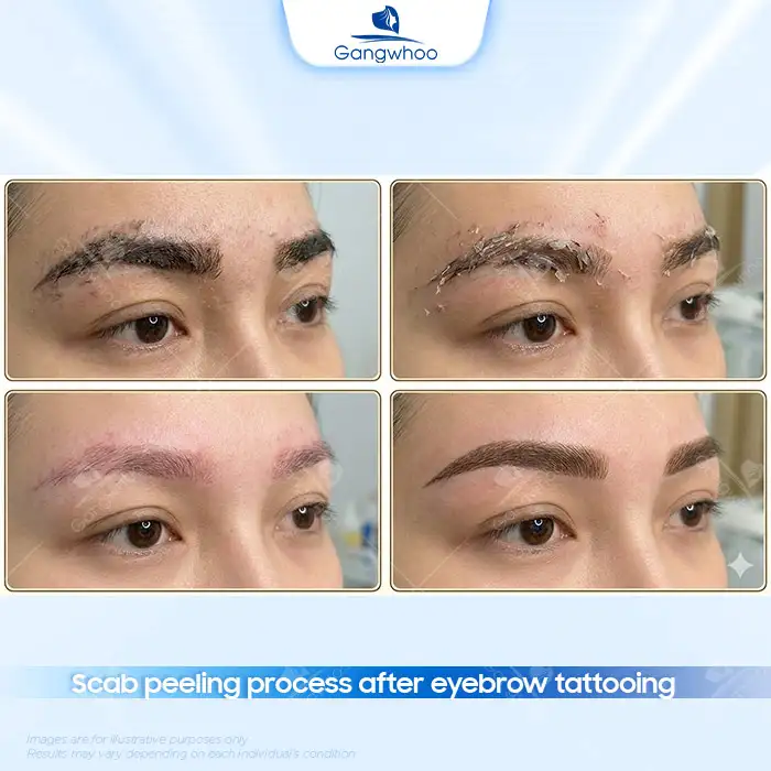 How Long Does Eyebrow Tattoo Peeling Take? Detailed Recovery Stages