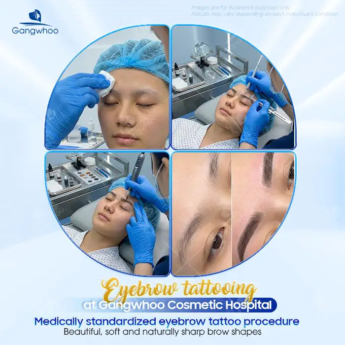 Where Is the Best Place for Eyebrow Tattooing? Criteria for Choosing a Reputable Eyebrow Tattooing Clinic