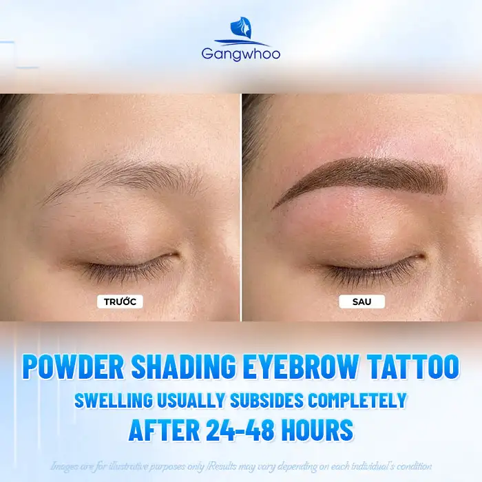 Does Powder Brows Cause Swelling? How Long Does the Swelling Last?
