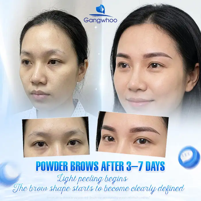 How Long Does Powder Brows Peeling Take? What Is the Recovery Timeline Like?