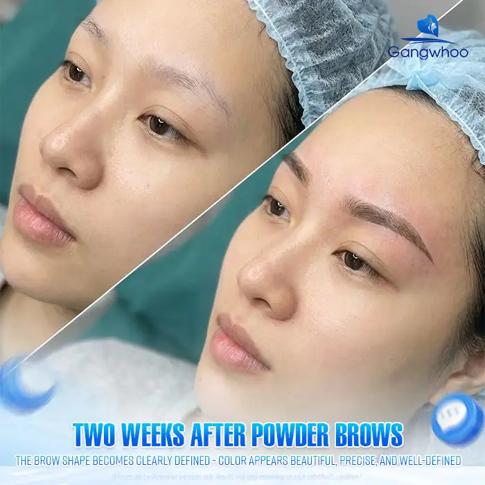 How Long Does Powder Brows Peeling Take? What Is the Recovery Timeline Like?