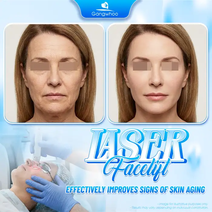Which Face Lift Method Is the Best? Explore the Most Effective Techniques