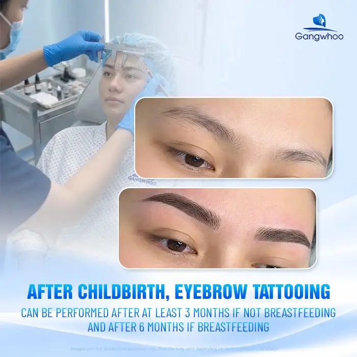 How Long After Childbirth Can You Get Eyebrow Tattooing? Important Considerations Before the Procedure