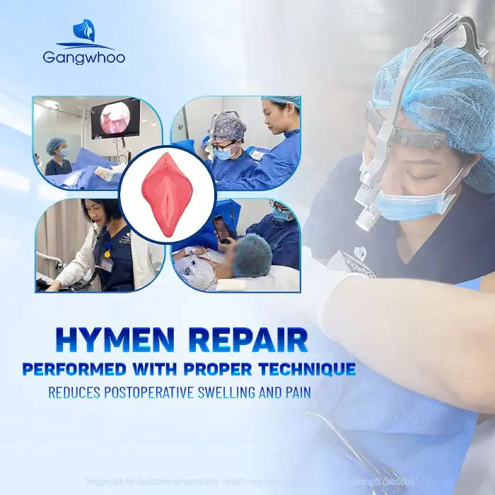 Does Hymen Repair Hurt? Sensations During and After Hymen Repair
