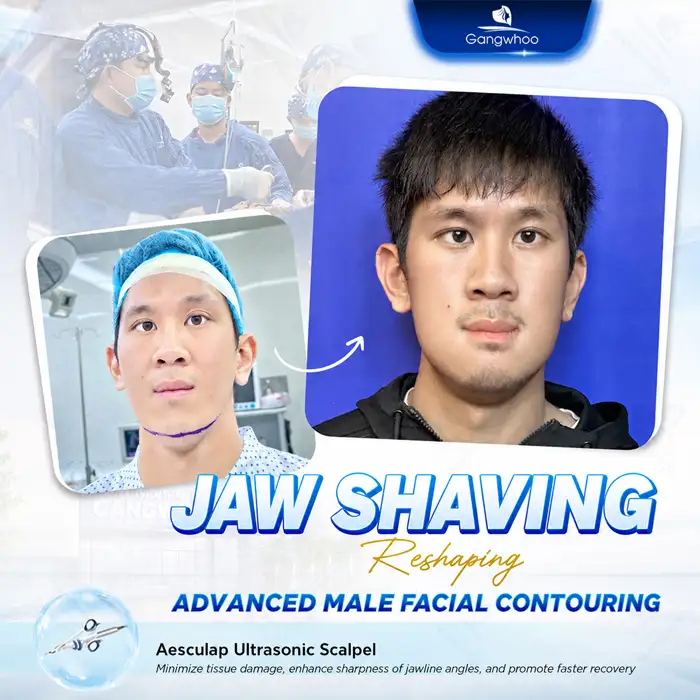 What Is Protruding Jaw Bone Reduction? Advantages, Disadvantages, and the Procedure