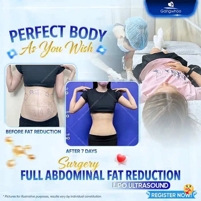 Will Liposuction Cause Weight Gain Again? Causes and Prevention Methods