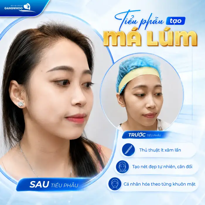Má Lúm Đồng Điếu Là Gì? Có Ý Nghĩa Gì Và Có Thể Tạo Được Không?