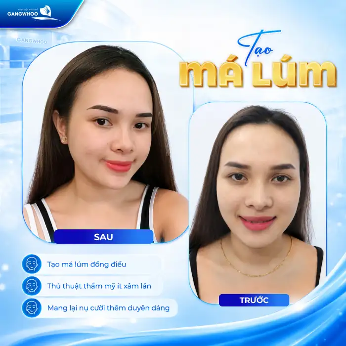 Má Lúm Đồng Điếu Là Gì? Có Ý Nghĩa Gì Và Có Thể Tạo Được Không?