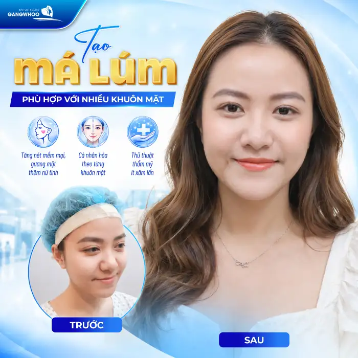 Má Lúm Đồng Điếu Là Gì? Có Ý Nghĩa Gì Và Có Thể Tạo Được Không?