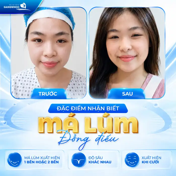 Má Lúm Đồng Điếu Là Gì? Có Ý Nghĩa Gì Và Có Thể Tạo Được Không?
