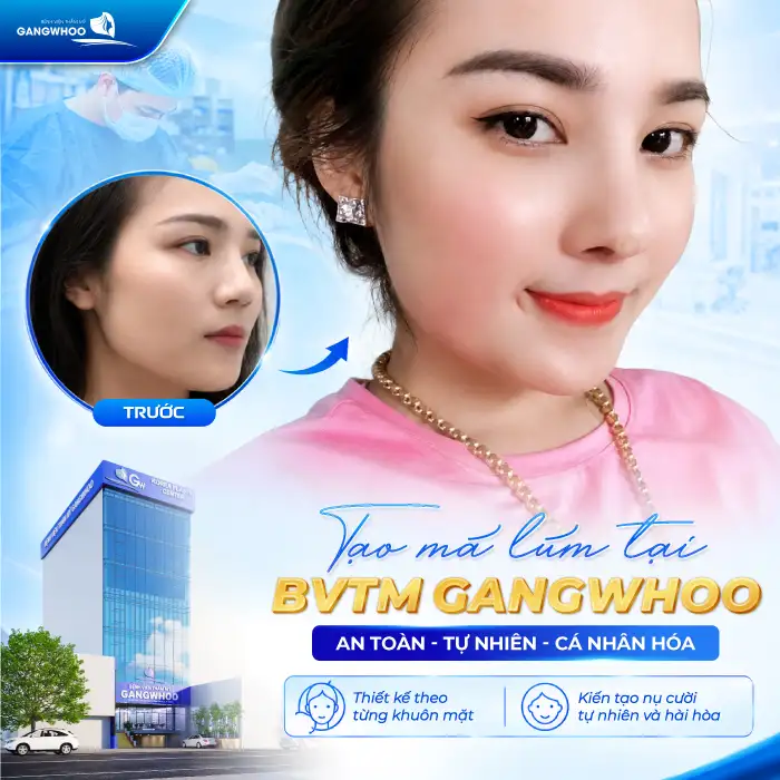 Má Lúm Đồng Điếu Là Gì? Có Ý Nghĩa Gì Và Có Thể Tạo Được Không?