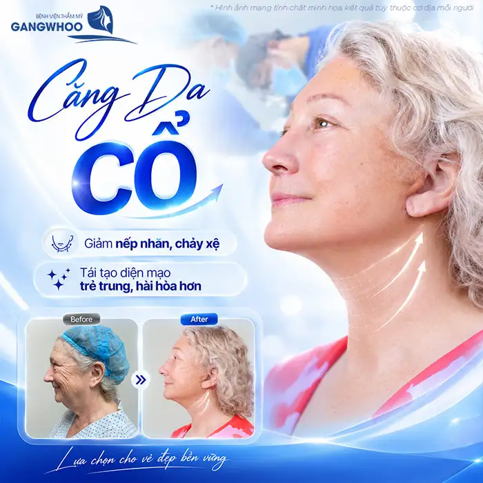 Căng Da Cổ Giá Bao Nhiêu Tiền? Bảng Giá Căng Da Mới Nhất