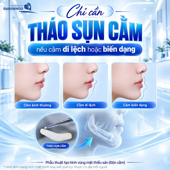 Is Chin Augmentation Permanent? A Detailed Explanation by the Doctor