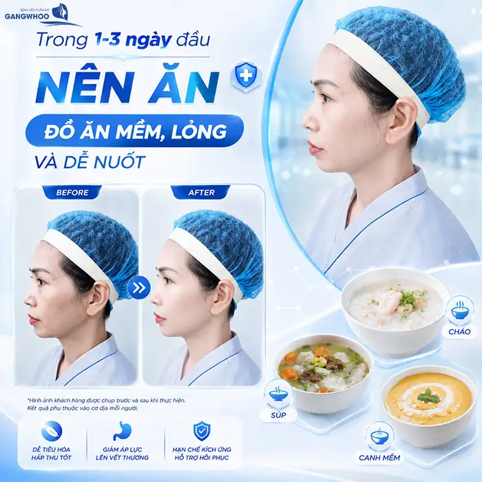 What Foods Should You Avoid After Chin Augmentation to Help the Wound Heal Quickly?