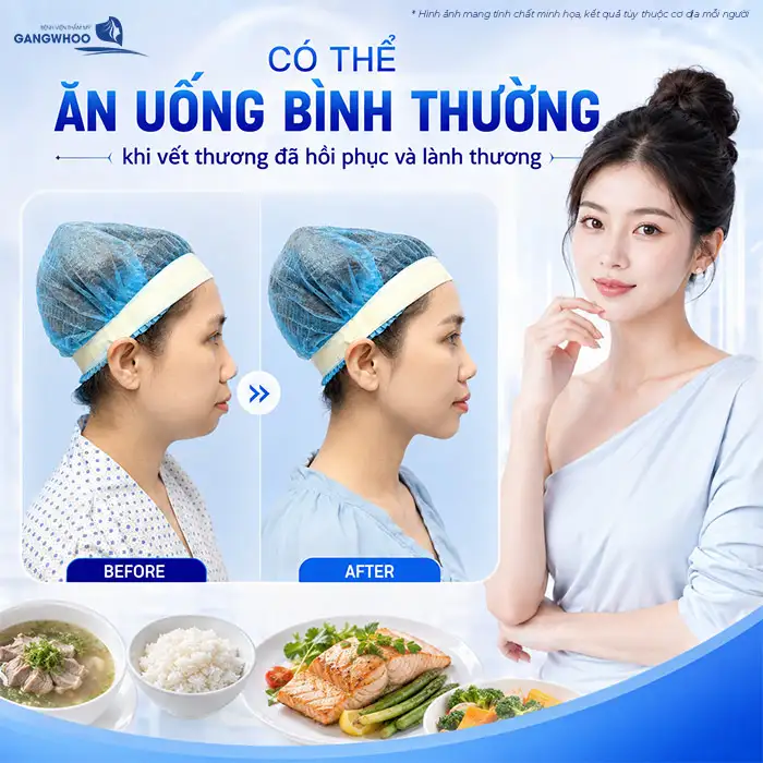 What Foods Should You Avoid After Chin Augmentation to Help the Wound Heal Quickly?