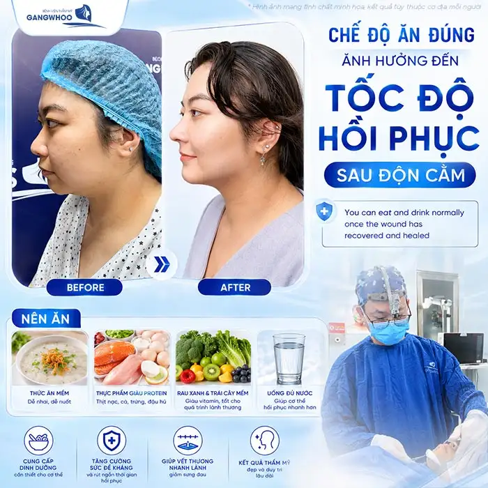 What Foods Should You Avoid After Chin Augmentation to Help the Wound Heal Quickly?