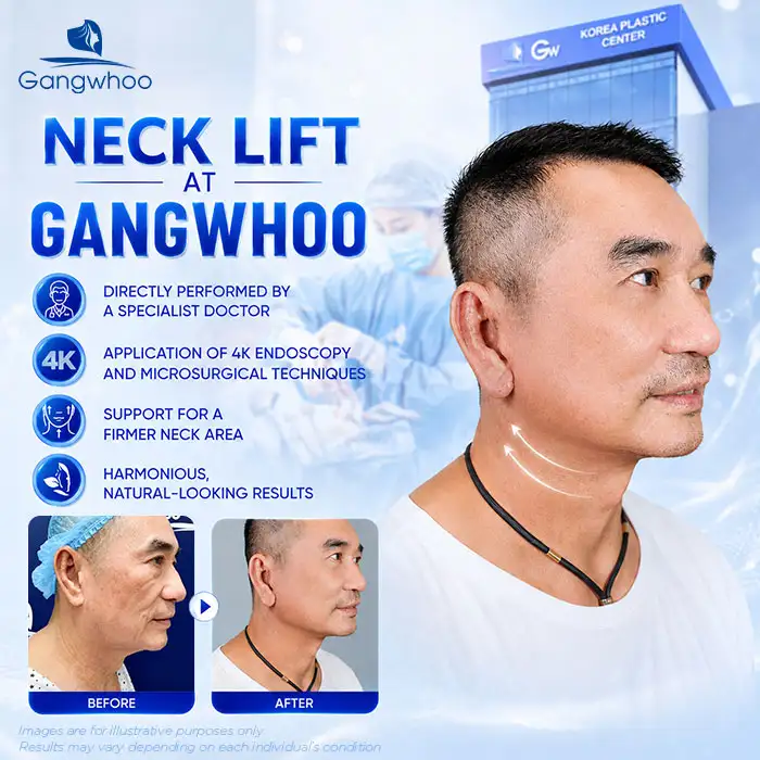 How Much Does a Neck Lift Cost? Latest Neck Lift Price List