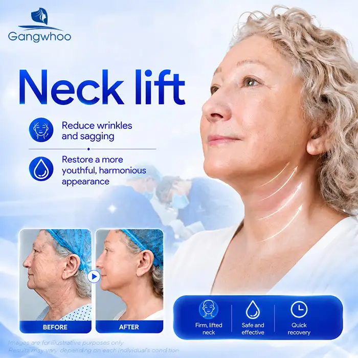 How Much Does a Neck Lift Cost? Latest Neck Lift Price List