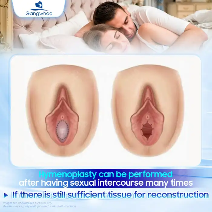 Lưu nháp tự động