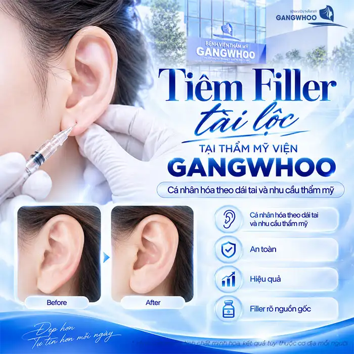 How Many CCs of Filler Are Needed for Fortune Ears? Doctor Advises on the Appropriate Filler Volume