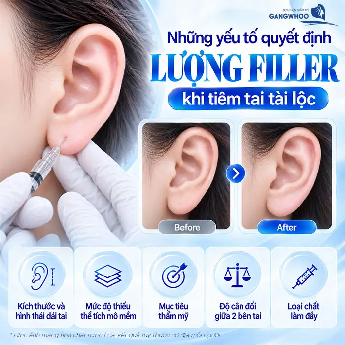 Factors That Determine the Amount of Filler for Fortune Ear Injections