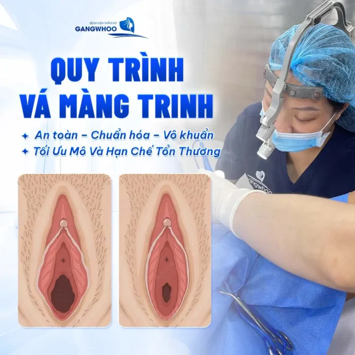 Vá Màng Trinh Có Nguy Hiểm Không? Bác Sĩ Thẩm Mỹ Giải Đáp