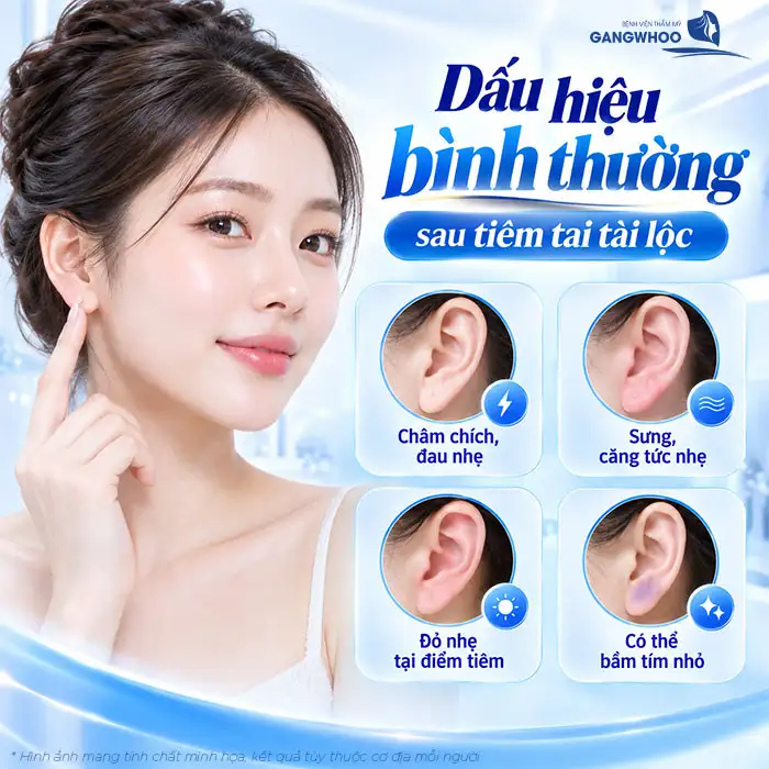 Tiêm Tai Tài Lộc Có Đau Không? Có Cần Gây Tê, Sưng Đau Bao Lâu?