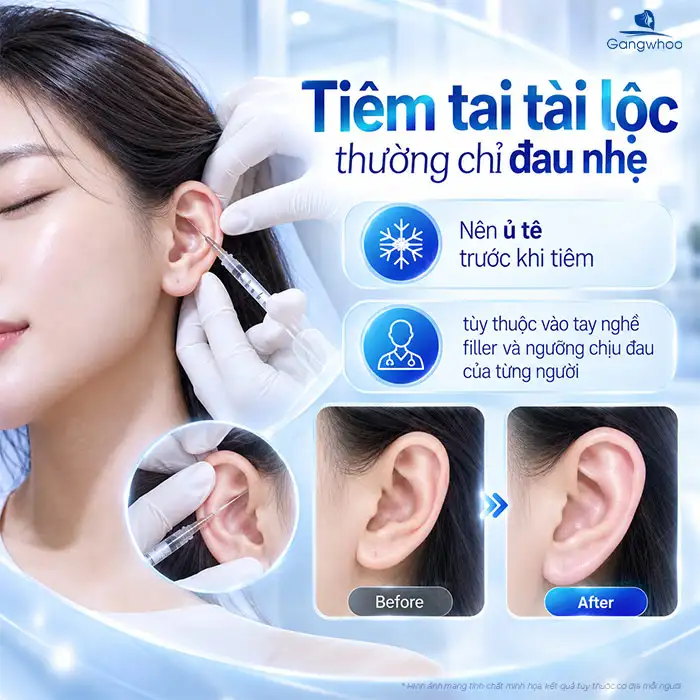 Tiêm Tai Tài Lộc Có Đau Không? Có Cần Gây Tê, Sưng Đau Bao Lâu?