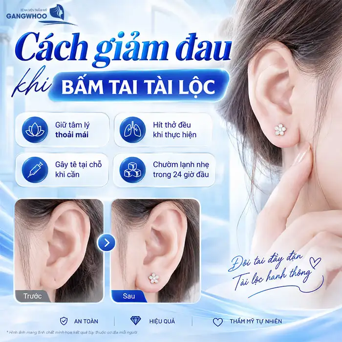Tiêm Tai Tài Lộc Có Đau Không? Có Cần Gây Tê, Sưng Đau Bao Lâu?