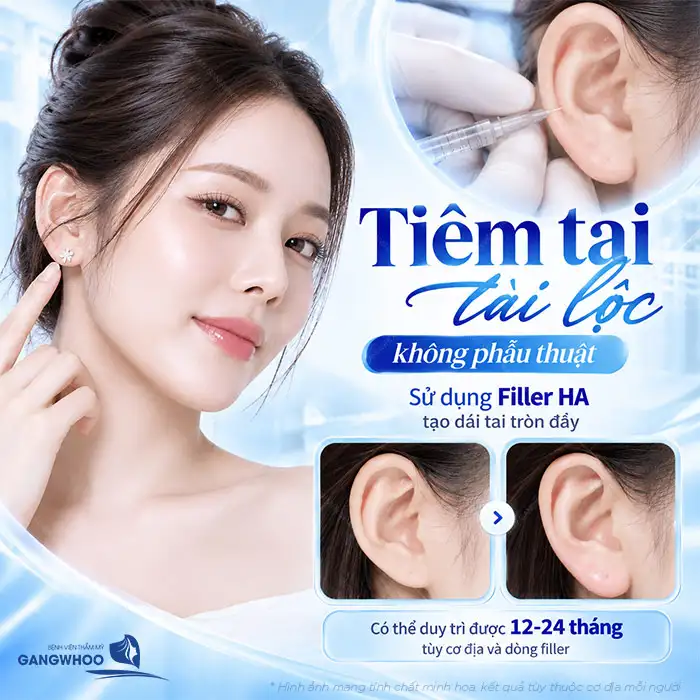 Tiêm Tai Tài Lộc Giá Bao Nhiêu? Có Nên Tiêm Filler Giá Rẻ