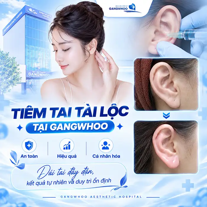 Tiêm Tai Tài Lộc Giá Bao Nhiêu? Có Nên Tiêm Filler Giá Rẻ