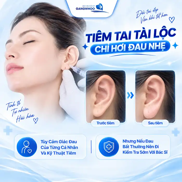 Tiêm Tai Tài Lộc Giá Bao Nhiêu? Có Nên Tiêm Filler Giá Rẻ