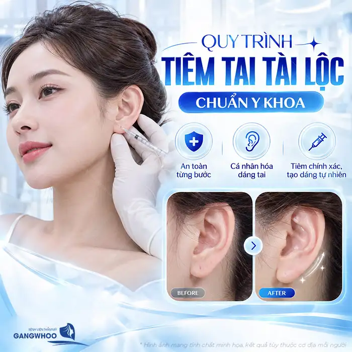 Tiêm Tai Tài Lộc Giá Bao Nhiêu? Có Nên Tiêm Filler Giá Rẻ