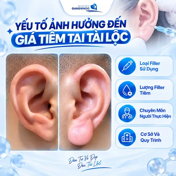 Tiêm Tai Tài Lộc Giá Bao Nhiêu? Có Nên Tiêm Filler Giá Rẻ