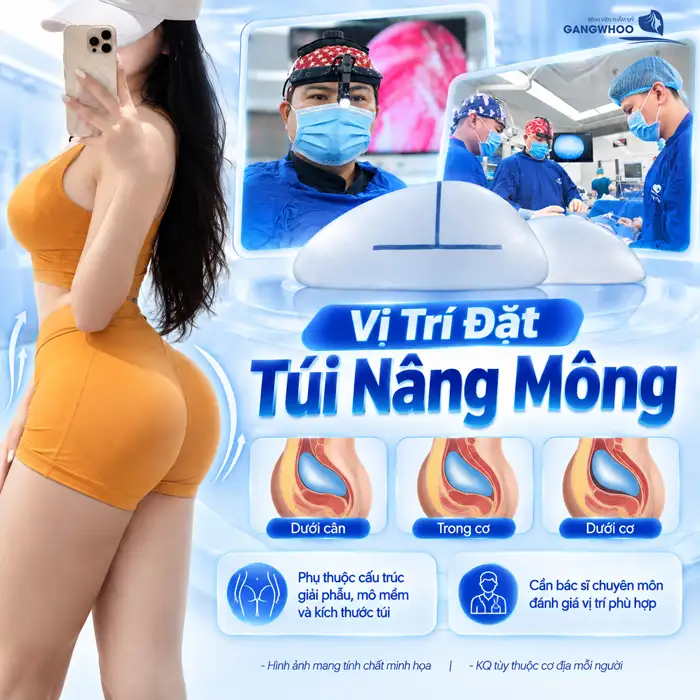 Túi Nâng Mông Loại Nào Tốt? Đặt Túi Nâng Mông Có An Toàn Không?