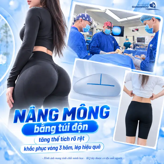 Túi Nâng Mông Loại Nào Tốt? Đặt Túi Nâng Mông Có An Toàn Không?