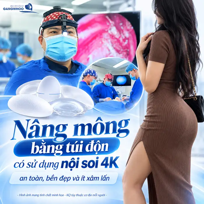 Túi Nâng Mông Loại Nào Tốt? Đặt Túi Nâng Mông Có An Toàn Không?