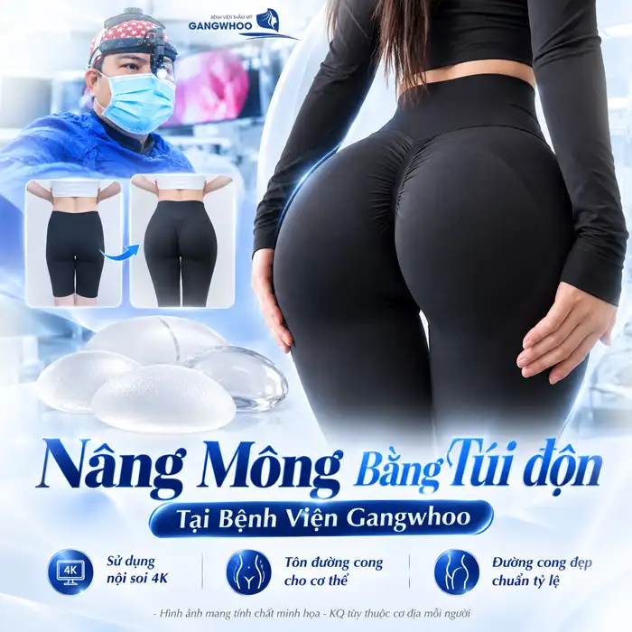 Túi Nâng Mông Loại Nào Tốt? Đặt Túi Nâng Mông Có An Toàn Không?