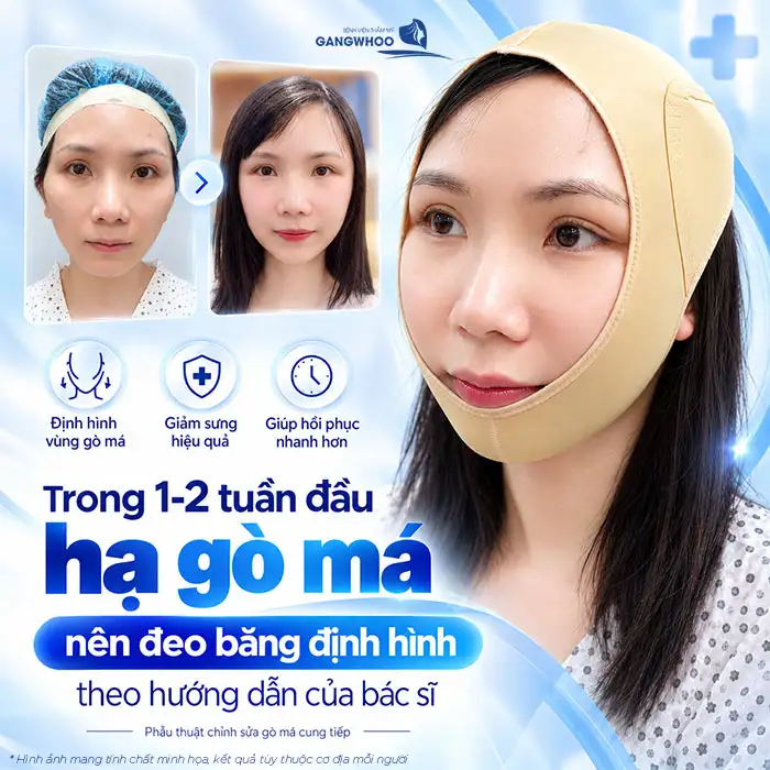 Hạ Gò Má Có Bị Xệ Mặt Không? Nguyên Nhân & Cách Khắc Phục Triệt Để